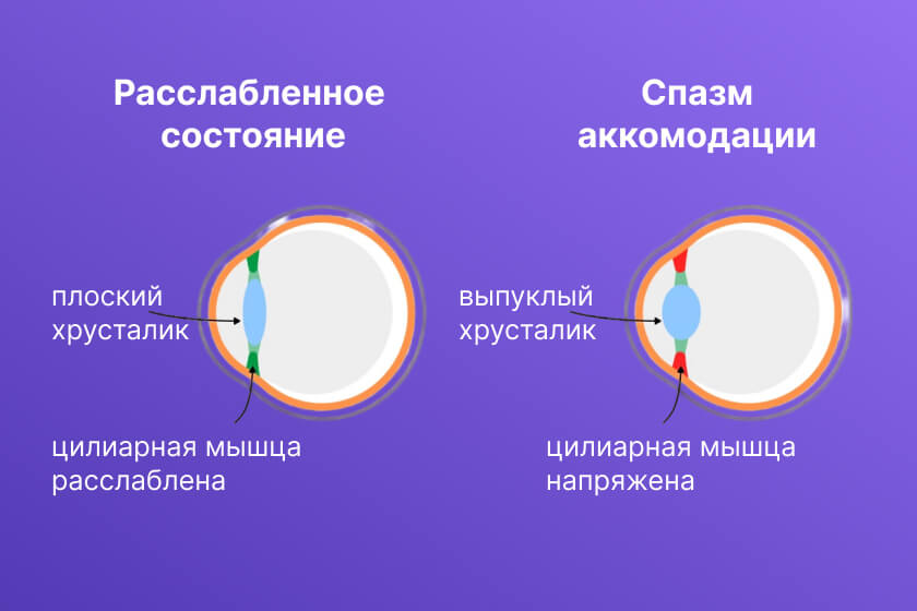 портится ли зрение от телефона в очках